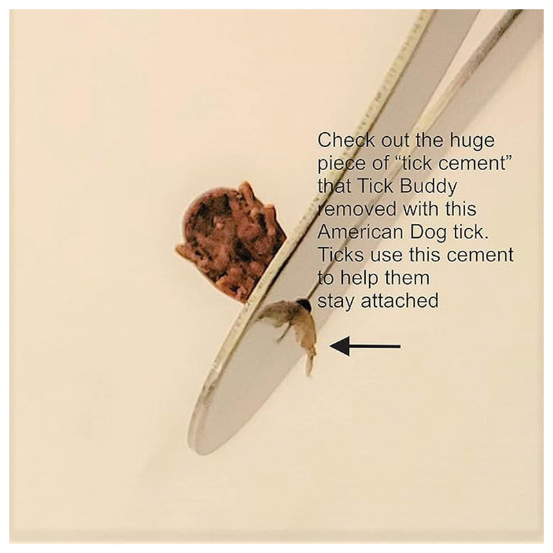 Load image into Gallery viewer, Pro-tick Tick Buddy: Your Ultimate Companion for Tick Protection