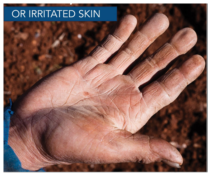 Load image into Gallery viewer, Relief on-the-go: Dermatone Camphor Ice Stick 1oz