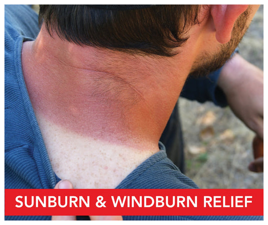 Relief on-the-go: Dermatone Camphor Ice Stick 1oz